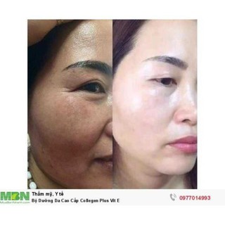 Bộ kem cao cấp colagen Plus Vit e