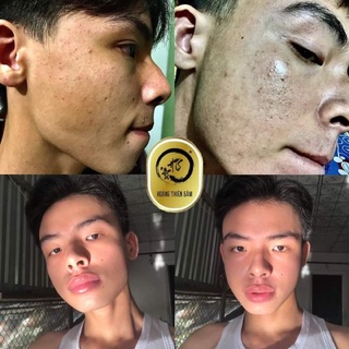 [FREESHIP] Combo Dưỡng Hoàng Thiên Sâm