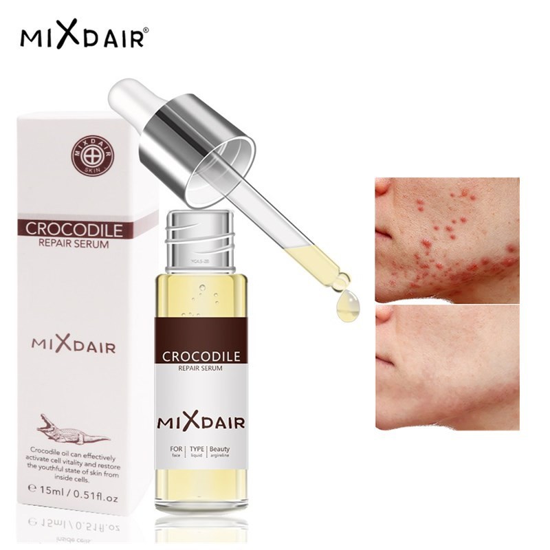 Tinh chất trắng da MIXDAIR làm sáng da dưỡng ẩm kiềm dầu chống nếp nhăn 15ml