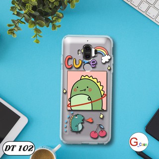 Ốp lưng dẻo Huawei Mate 9