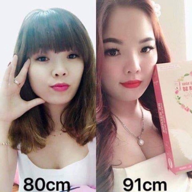 ❤Mầm Đậu Nành Tăng V1 Minh Lady Beauty❤bổ sung thêm sâm tố nữ và colagen