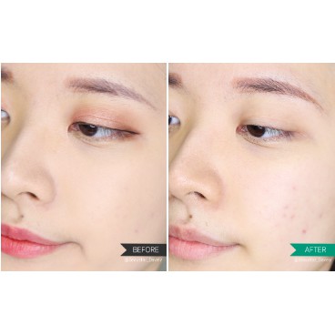Sữa Rửa Mặt Tạo Bọt Dành Cho Da Mụn Senka Perfect Whip Acne Care | BigBuy360 - bigbuy360.vn