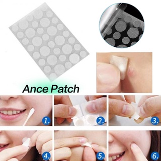 Set 36 Miếng Dán Hỗ Trợ Giảm Mụn Vô Hình