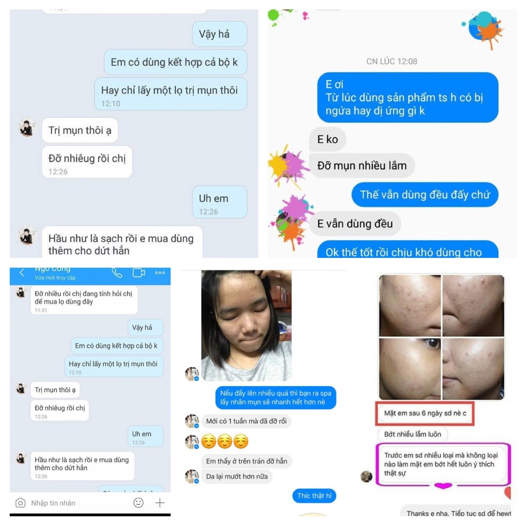 Kem ngừa mụn đẩy nhân mụn, mờ thâm +Dr.Lee Cream.