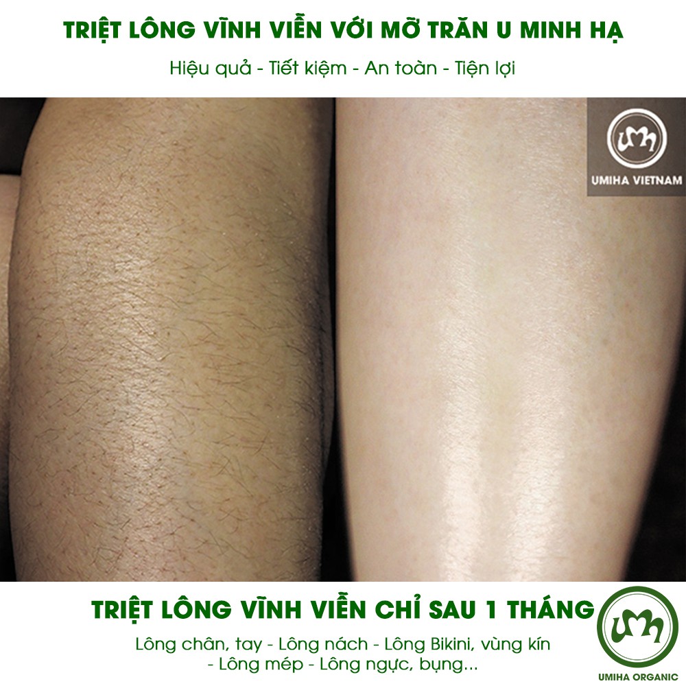 Combo 2 hộp Mỡ trăn triệt lông vĩnh viễn U Minh Hạ (30ml x2) UMIHA ORGANIC - Tặng Bột Cám Gạo hữu cơ Umihome 135G