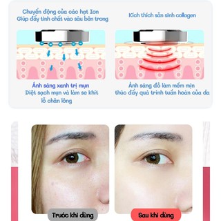 Máy massage mặt, rửa mặt, làm đẹp ion