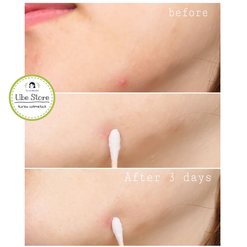 TINH DẦU TRÀM TRÀ CHẤM MỤN THE BODY SHOP TEA TREE OIL | BigBuy360 - bigbuy360.vn