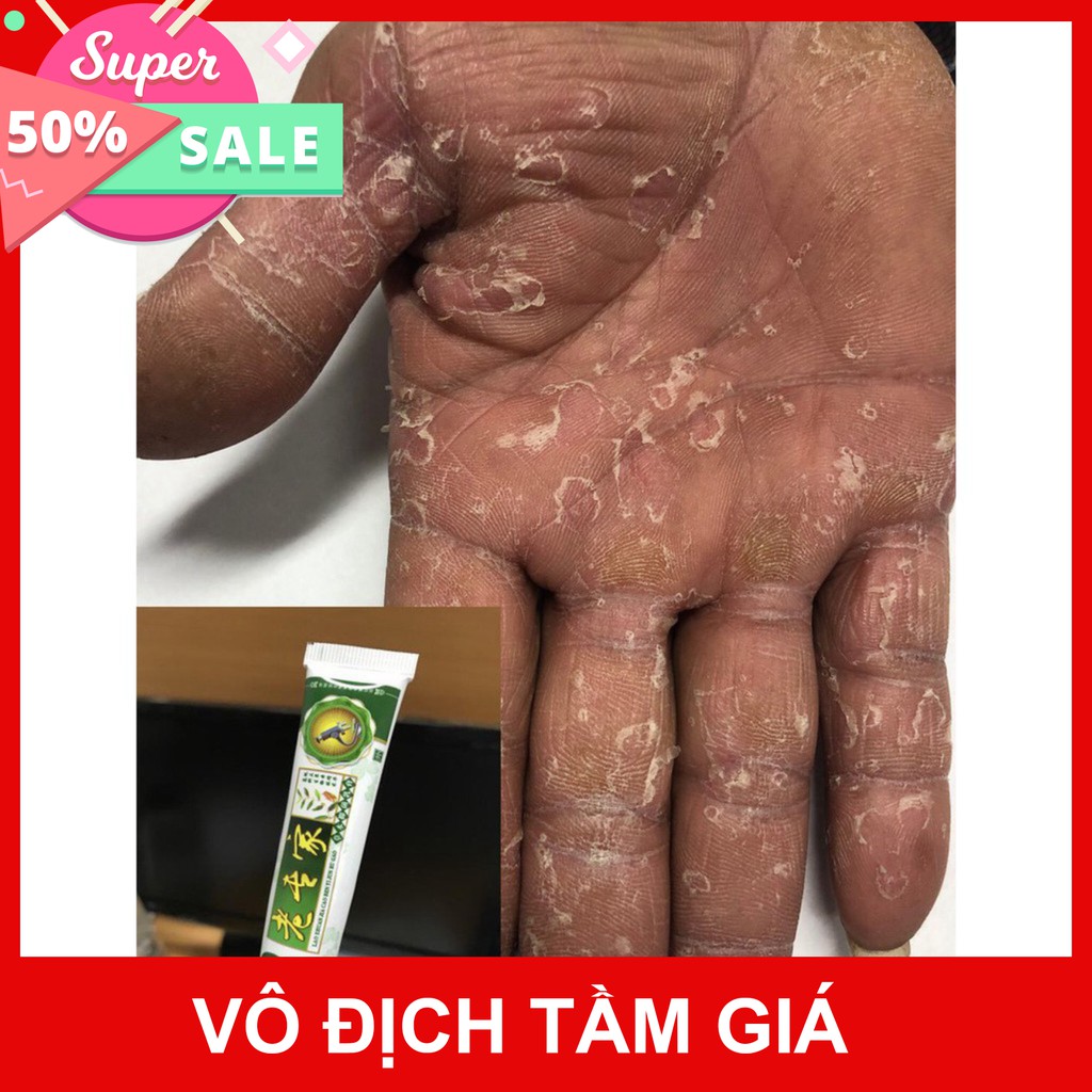 Kem bôi ngoài da chống nứt nẻ bong tróc khô da cực hiệu quả T2 chuyên sỉ sll [FREESHIP] [Mã FASHION10K hoàn 10K xu đơn 0 | BigBuy360 - bigbuy360.vn