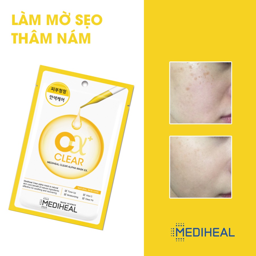 [Full Tem - Hàng Nhập Khẩu Chính Hãng  ] Mặt Nạ Mediheal Alpha Mask EX 23ml