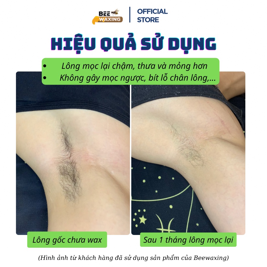 Sáp Wax Lông THƠM- Hạt Wax Beans Nóng Waxing Tại Nhà [Tặng Kèm Que Wax]