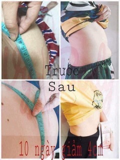 GEL TAN MỠ #VYBODY