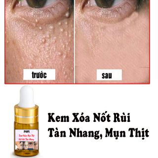 🌺Kem Xóa Nốt Ruồi