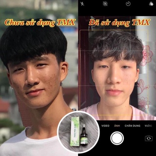 [Sẵn Hàng] Thảo Mộc xanh 3 lọ