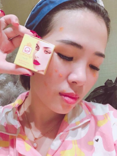 Kem Nghệ Ngừa Mụn Q’CARE WHITE 5g - Thái Lan