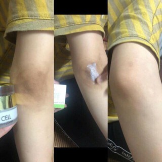 KEM HÚT THÂM OL CELL HÀN QUỐC