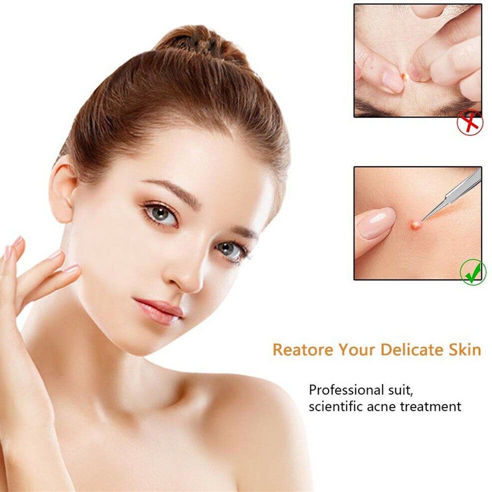 [Hàng mới về] Set dụng cụ nặn mụn đầu đen bằng thép không gỉ chăm sóc da mặt có túi đựng