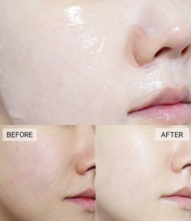 Mặt nạ Melano CC