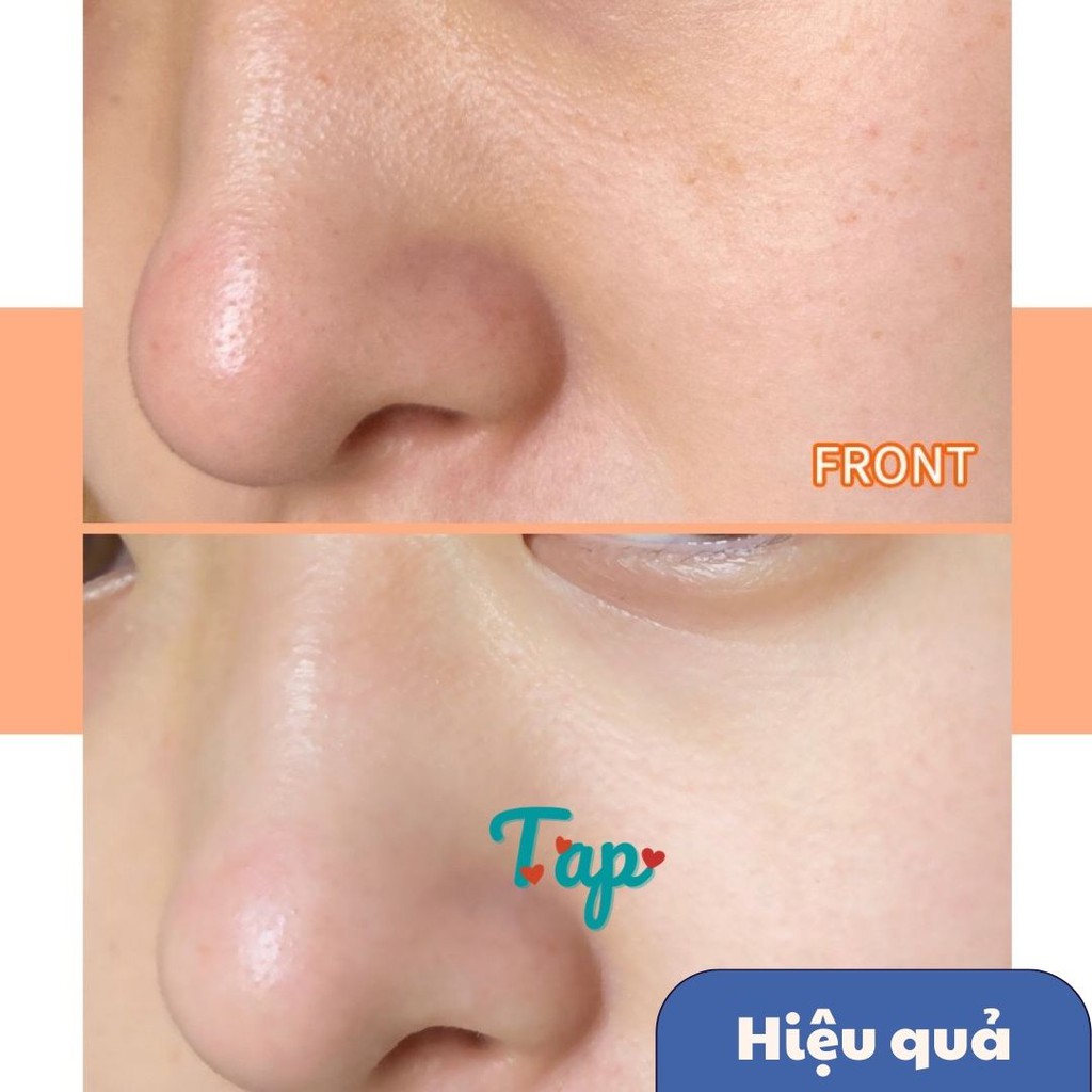 (12 gói) Mặt nạ bùn ốc sên/nha đam thu nhỏ lỗ chân lông làm sáng da