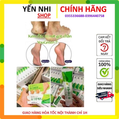 Kem giảm nứt gót chân YouGreen Hàn Quốc 60gr