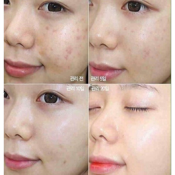 Tinh chất rau má Skin1004 Madagascar Centella Ampoule - 55ml