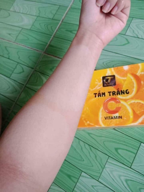 Tắm trắng vitamin c