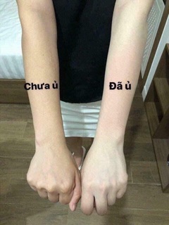 Ủ SỮA NON KÍCH TRẮNG