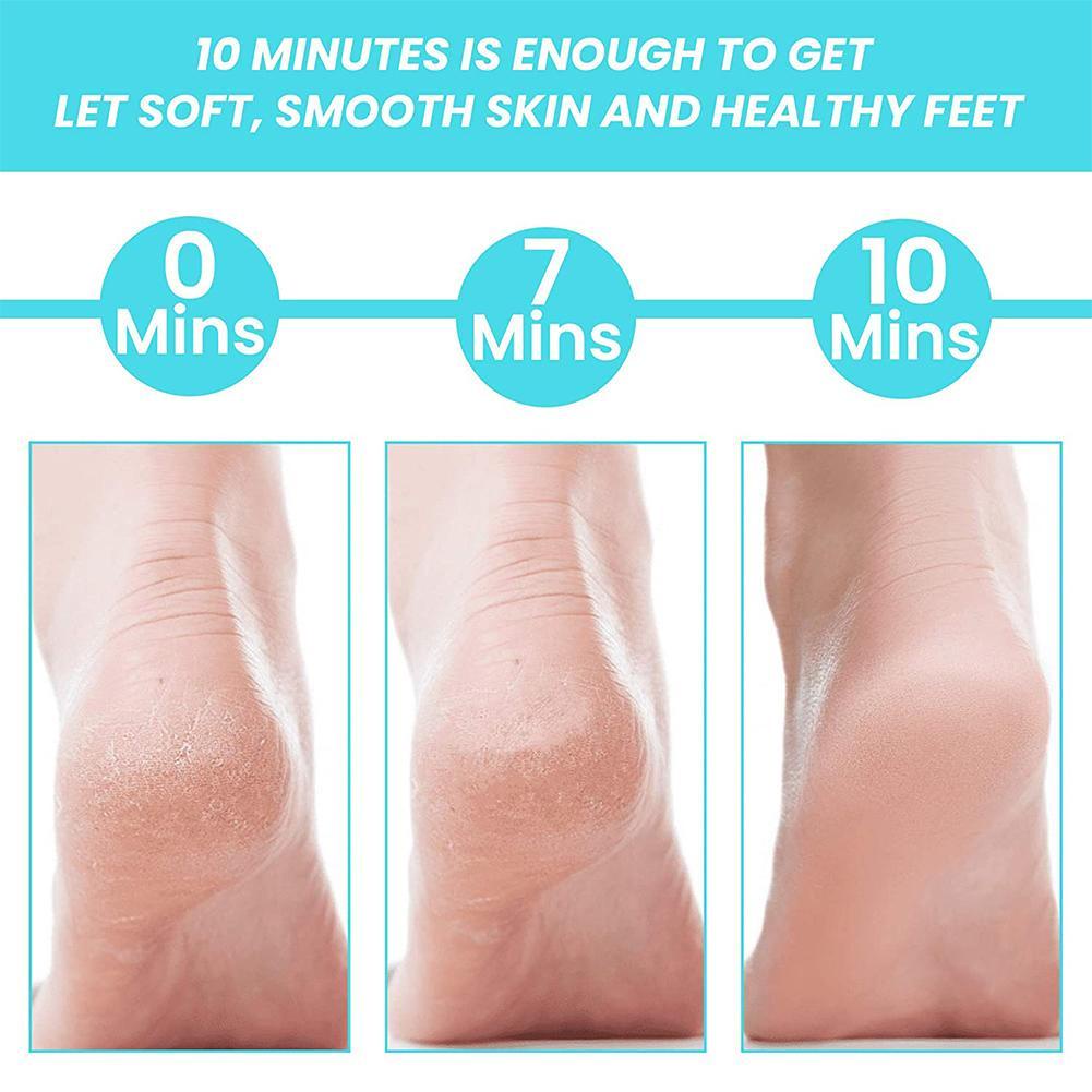 1 Dụng Cụ Tẩy Tế Bào Chết Cho Chân A2P1