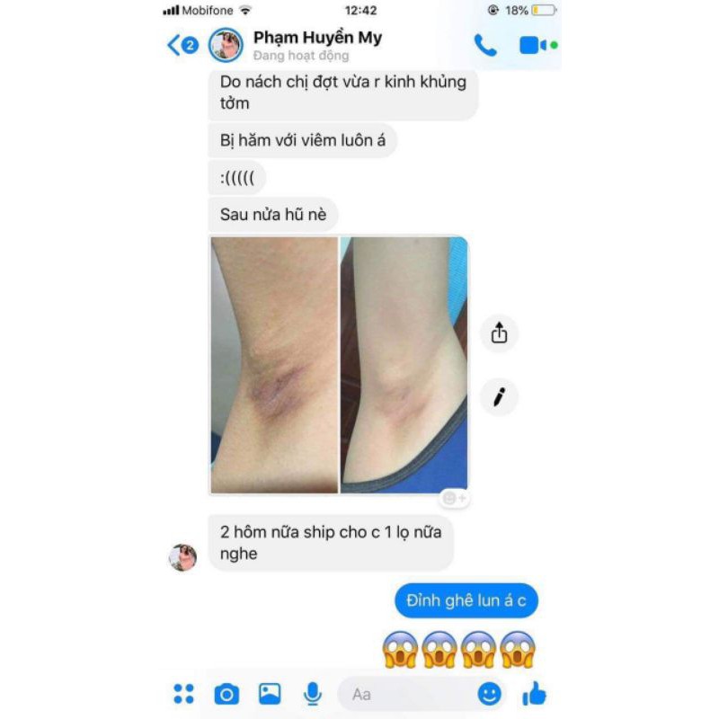 (TẶNG QUÀ XINH) COMBO 2 LỌ KEM LOẠI BỎ THÂM NÁCH - HÔI NÁCH CÔ BƠ | BigBuy360 - bigbuy360.vn