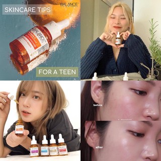 Serum balance vitamin c
