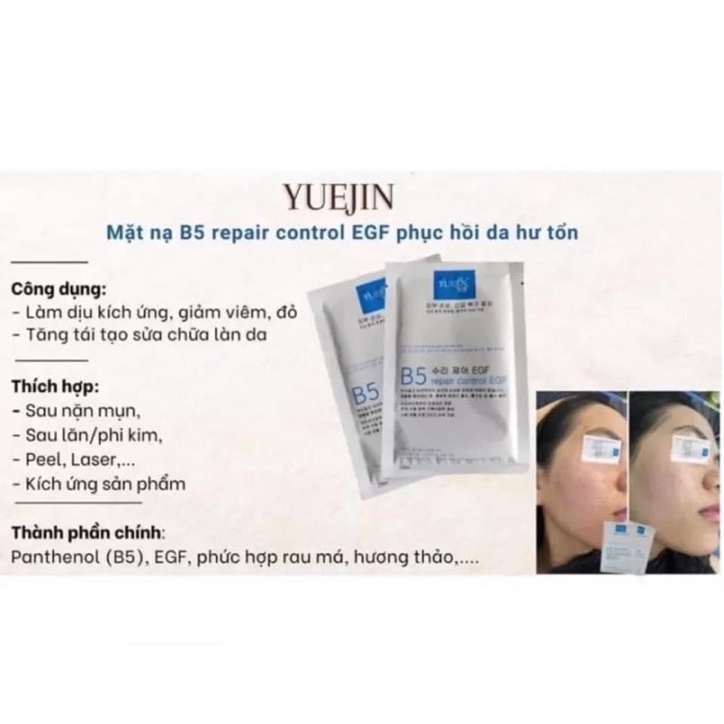 Mặt nạ cấp ẩm phục hồi B5 Yuejin Control EGF Mask