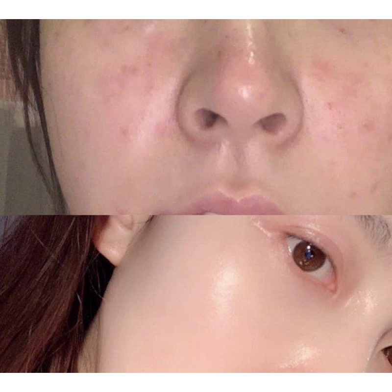 HỘP 30 GÓI COLLAGEN LỰU HÀN QUỐC | BigBuy360 - bigbuy360.vn