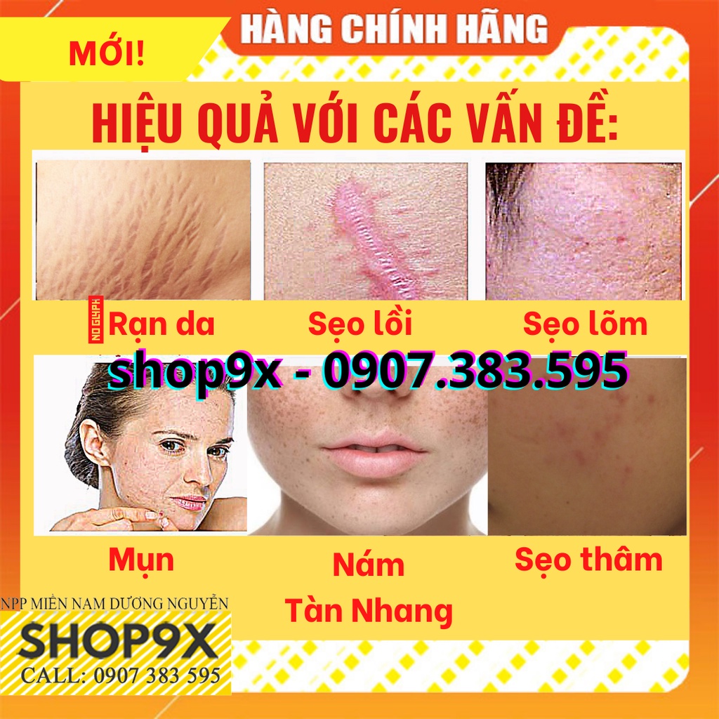 Kem Klirvin Nga Auth -  Ngăn Ngừa Sẹo, Mụn, Thâm, Nám, Rạn Da 25g