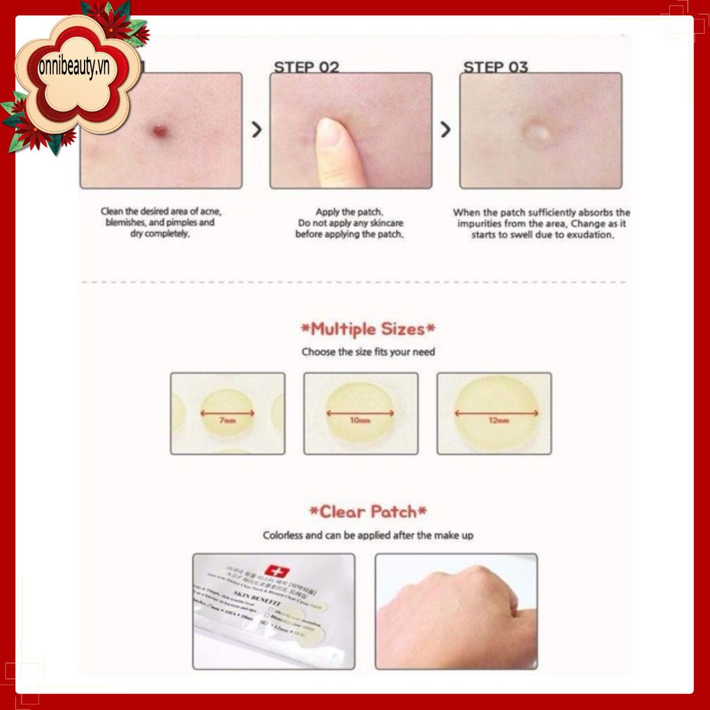 Miến Dán Mụn [FREESHIP] Miếng dán mụn Cosrx 24 miếng Acne Pimple Master Patch