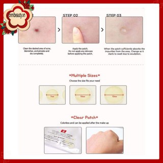 Miến Dán Mụn Miếng dán mụn Cosrx 24 miếng Acne Pimple Master Patch