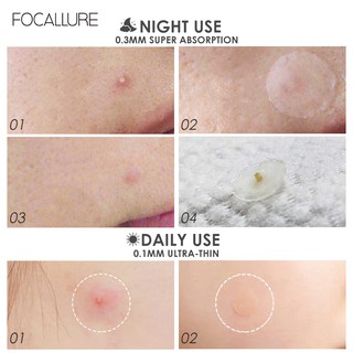 Miếng dán mụn kiểm soát dầu không thấm nước
