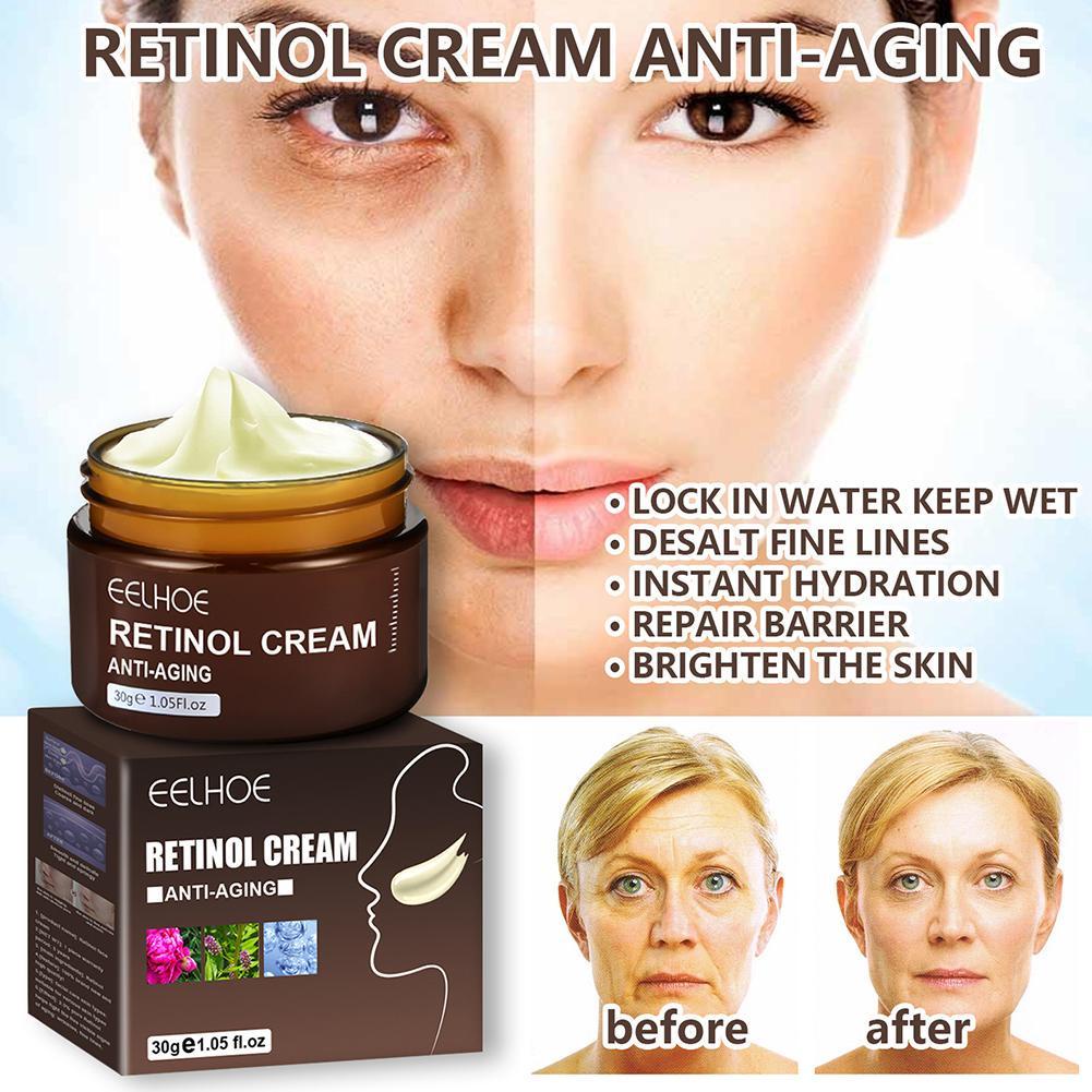 Kem Dưỡng Da Mặt Retinol Chống Lão Hóa Xóa Nếp Nhăn Làm Trắng Và Làm Săn Chắc Da O7Z8
