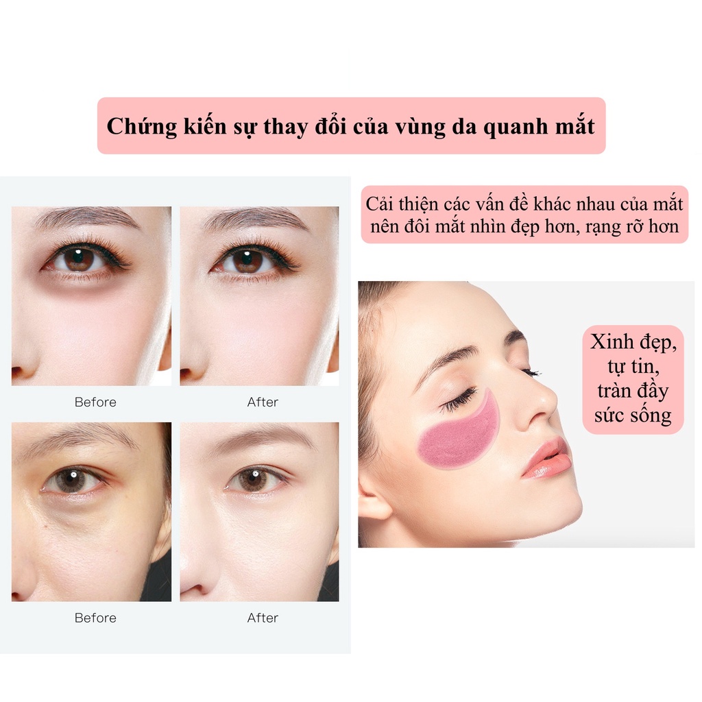 Mặt nạ mắt IMAGES giảm quầng thâm, dưỡng ẩm, dưỡng trắng vùng da quanh mắt, giảm nếp nhăn, ngăn ngừa lão hóa SPU095
