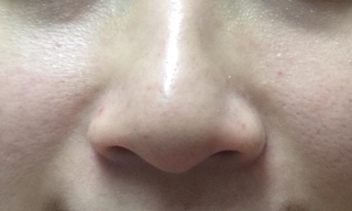 Mặt nạ lột mụn Good-bye Blackhead
