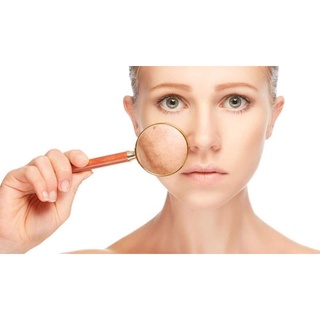 TẨY TẾ BÀO CHẾT ARRAHAN HÀN QUỐC