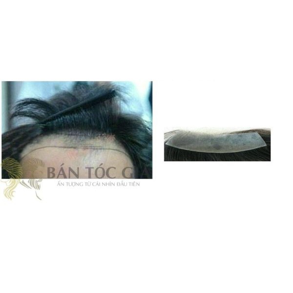Tóc Giả Nam Chữ M-Miếng dán tóc giả nam cho người trán hói chữ M – màng Poly-MSP:808D-1 Miếng