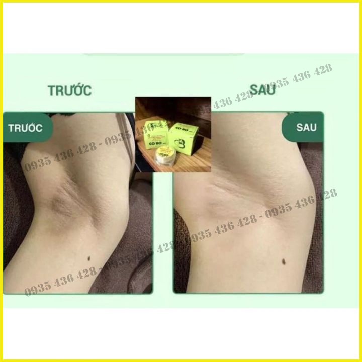 Kem Thâm Nách Hôi Nách - Kem Cô Bơ Chiết Xuất Từ Thiên Nhiên 100% - Mẹ Bầu Bỉm Đều Xài Được