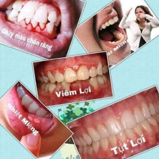 Bột trắng răng T-White