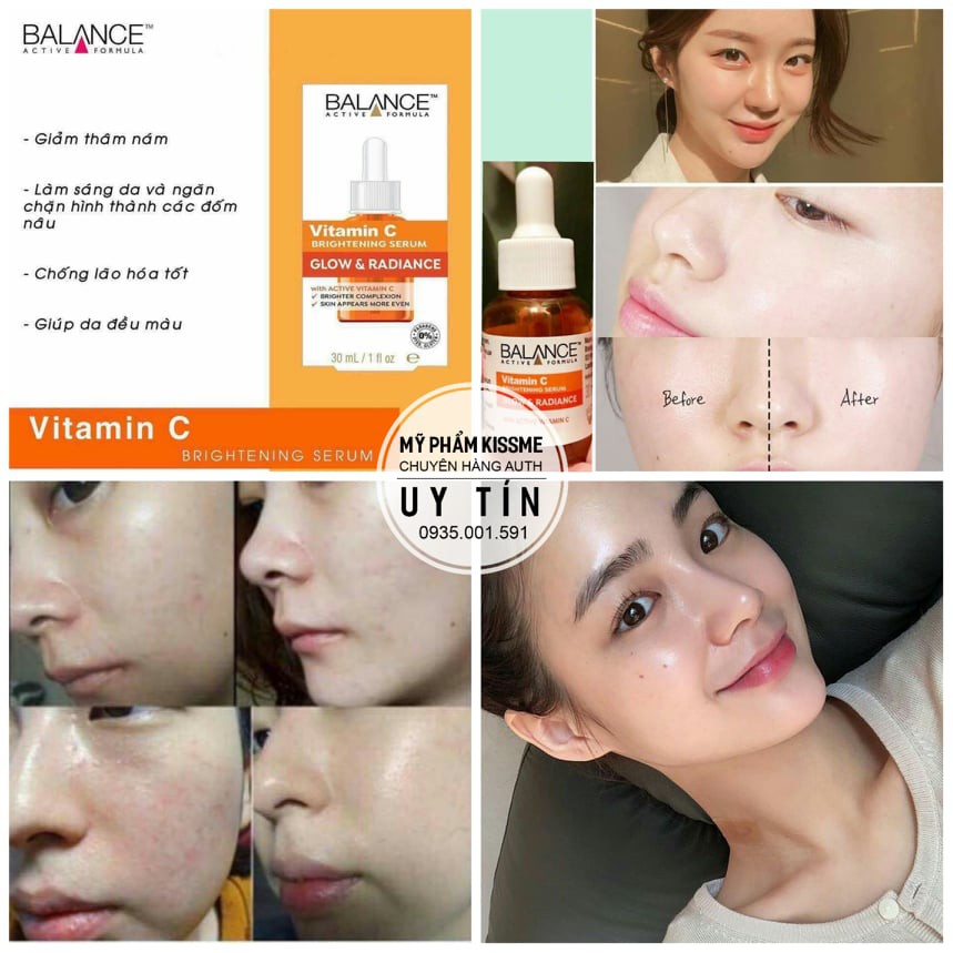 (CÓ BILL) Serum Sáng Da Mờ Thâm Balance Vitamin C Brightening