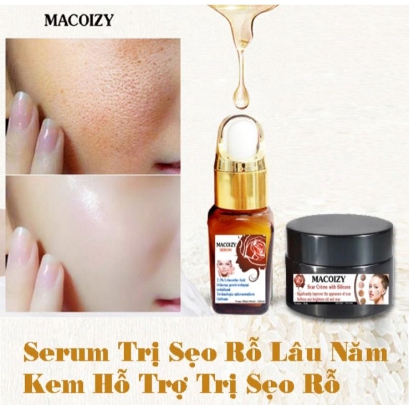 Combo serum Macoizy & Kem Xóa Sẹo rỗ