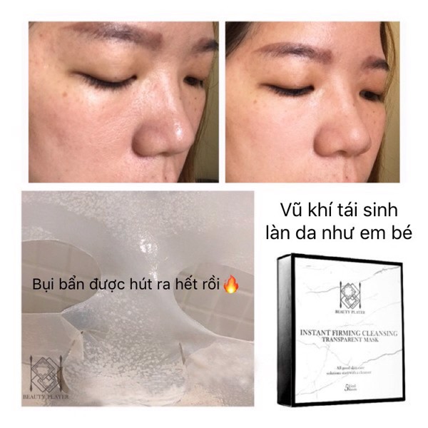 Beauty Player Mặt nạ hút sạch bụi bẩn và trắng sáng da (#TRẮNG)