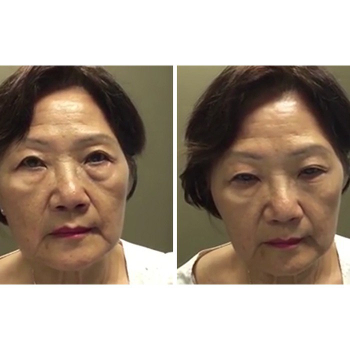 Kem Tan Bọng Mắt 🎁 FREESHIP 🎁 Giảm 50k nhập mã [HOI12] Tan Bọng Mắt Siêu Tốc | BigBuy360 - bigbuy360.vn