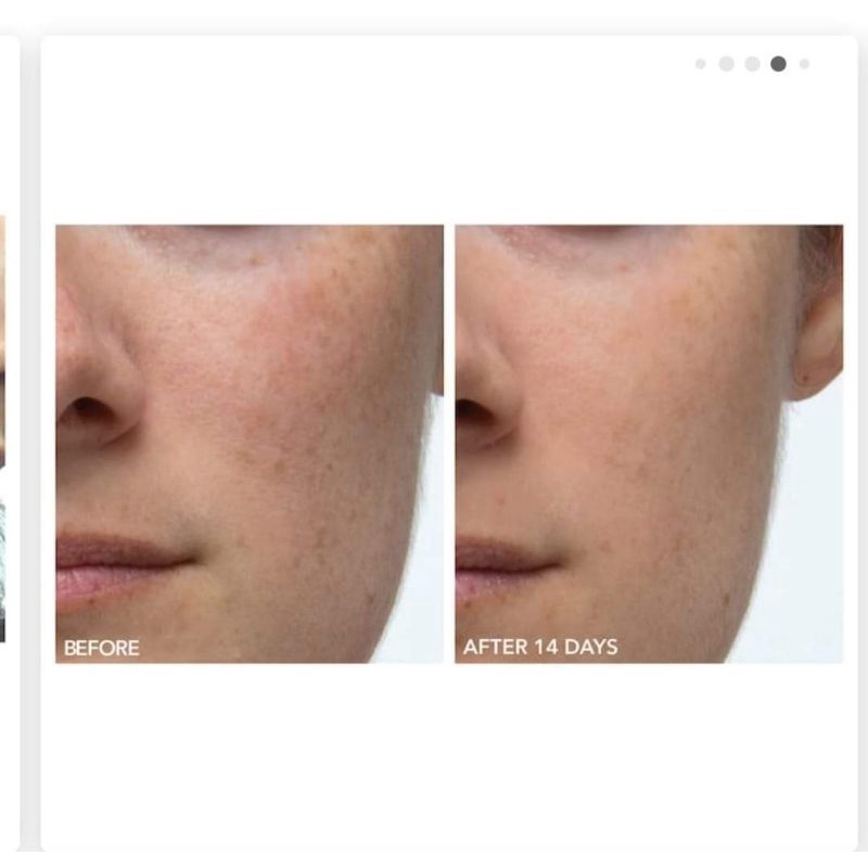 [ xả lỗ date 2026]  Dr Dennis Gross alpha beta peel tẩy da chết sét 2 gói | BigBuy360 - bigbuy360.vn