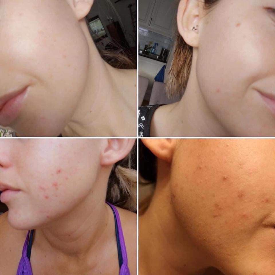 Tẩy tế bào chết hóa học neostrata oily skin solution 8AHA(BẢN MỸ) | BigBuy360 - bigbuy360.vn