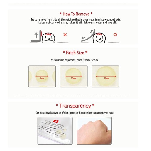 Miếng Dán Giảm Mụn/ Miếng Dán Trong Suốt Vừa Vặn