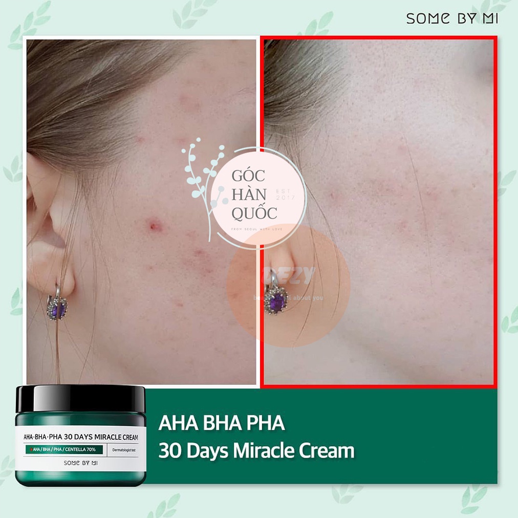 Kem Dưỡng Ẩm Some By Mi AHA BHA PHA Miracle Cream Trắng Da Ngừa Mụn Tối Ưu Olive Dưỡng Ẩm Kháng Khuẩn Ngừa Lão Hóa Dezy